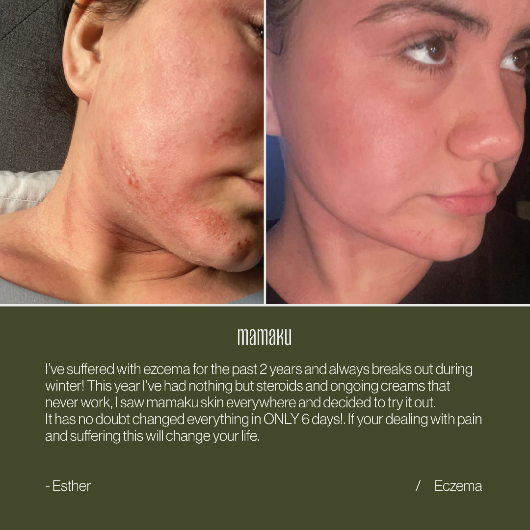 Ultra Hydra Moisturising Cream – mamakuskin